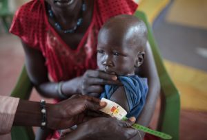 Child Malnutrition